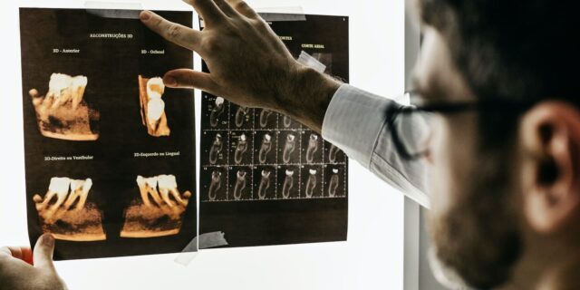 A person holds up X-ray images of dental scans against a lightbox, examining the details carefully, ensuring all HIPAA guidelines are meticulously followed.